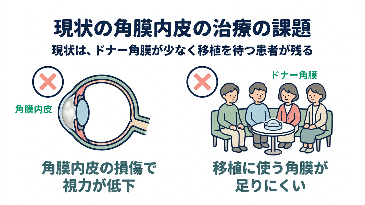 現状の角膜内皮の治療の課題｜現状は、ドナー角膜が少なく移植を待つ患者が残る｜角膜内皮の損傷で・視力が低下／移植に使う角膜が・足りにくい