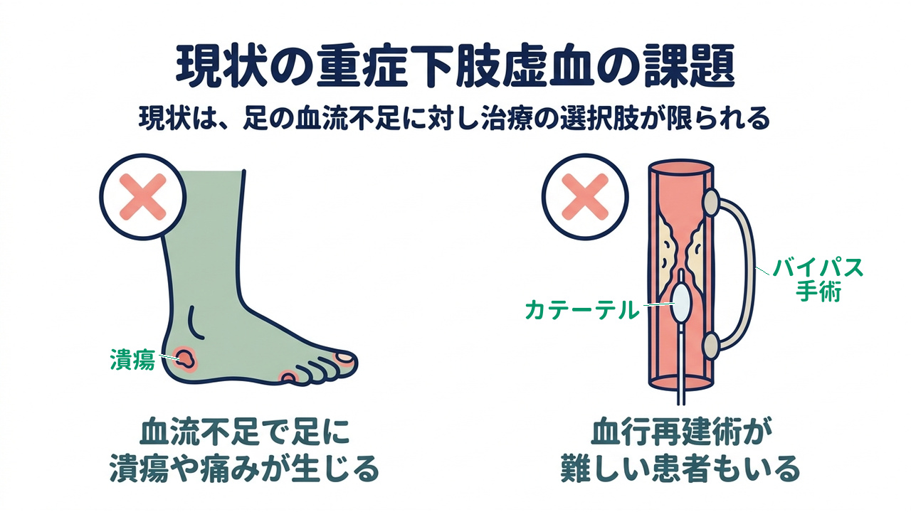 現状の重症下肢虚血の課題｜現状は、足の血流不足に対し治療の選択肢が限られる｜血流不足で足に・潰瘍や痛みが生じる／血行再建術が・難しい患者もいる