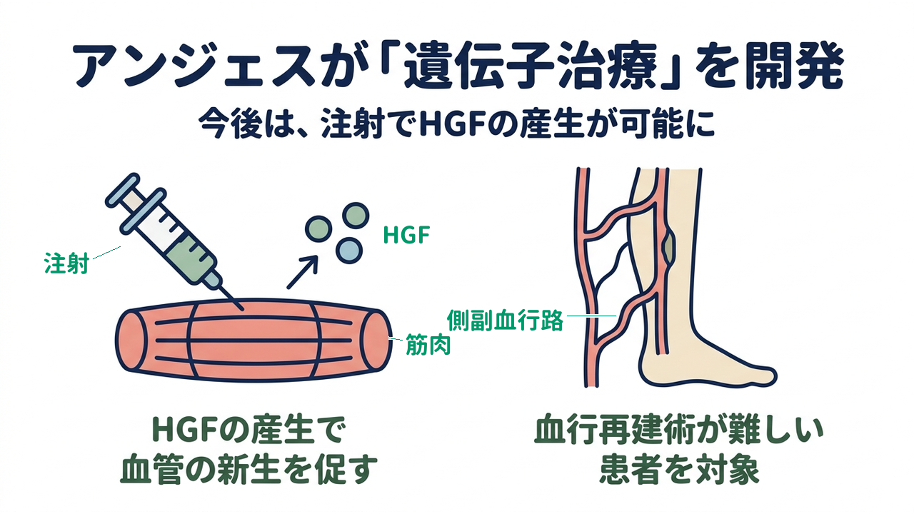 アンジェスが「遺伝子治療」を開発｜今後は、注射でHGFの産生が可能に｜HGFの産生で・血管の新生を促す／血行再建術が難しい・患者を対象