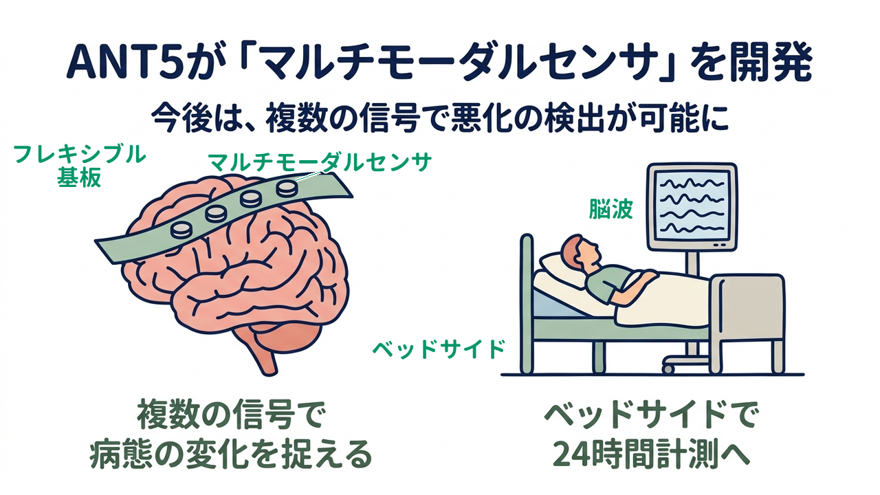 ANT5が「マルチモーダルセンサ」を開発