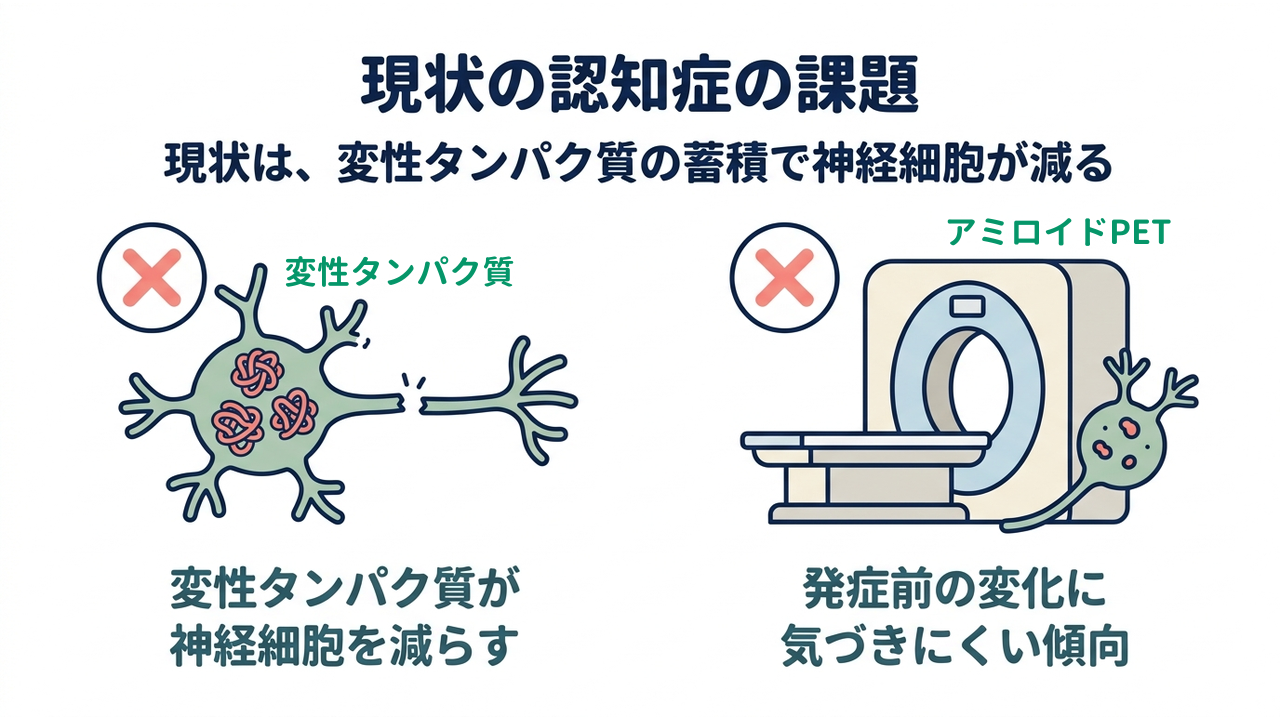 現状の認知症の課題|変性タンパク質が神経細胞を減らす/発症前の変化に気づきにくい傾向