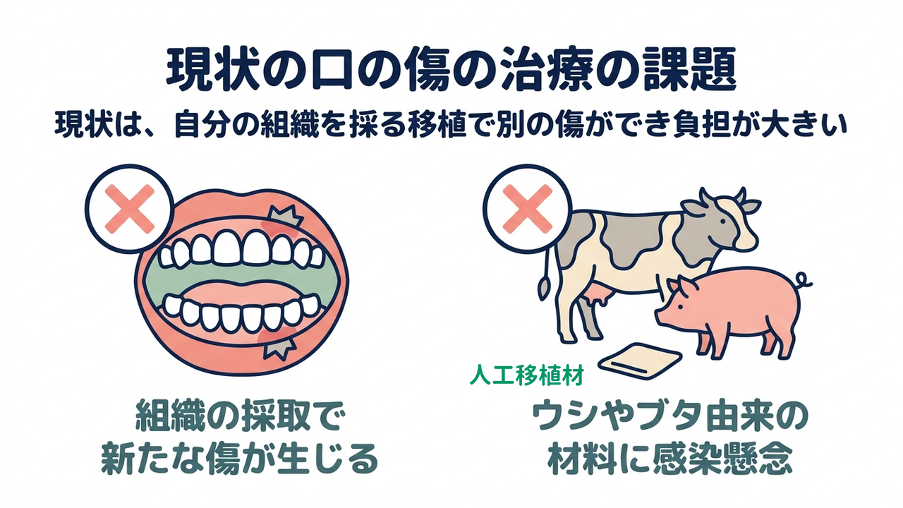 現状の口の傷の治療の課題｜現状は、自分の組織を採る移植で別の傷ができ負担が大きい｜組織の採取で・新たな傷が生じる／ウシやブタ由来の・材料に感染懸念