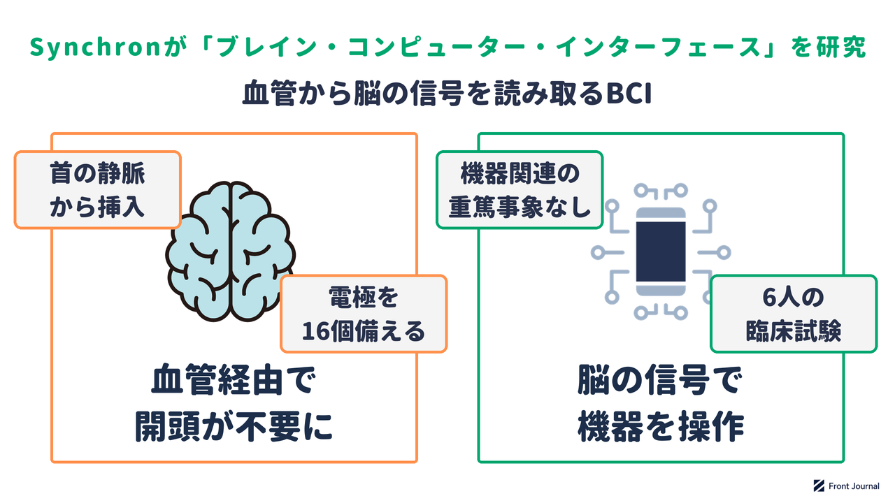 ブレイン・コンピューター・インターフェースの研究を示す図。首の静脈から脳の血管へ電極を送り込み、開頭せずに脳の信号でデジタル機器を操作する