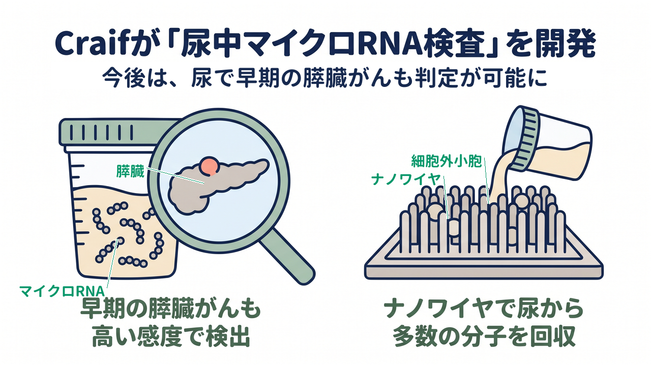 Craifが「尿中マイクロRNA検査」を開発｜早期の膵臓がんも高い感度で検出／ナノワイヤで尿から多数の分子を回収