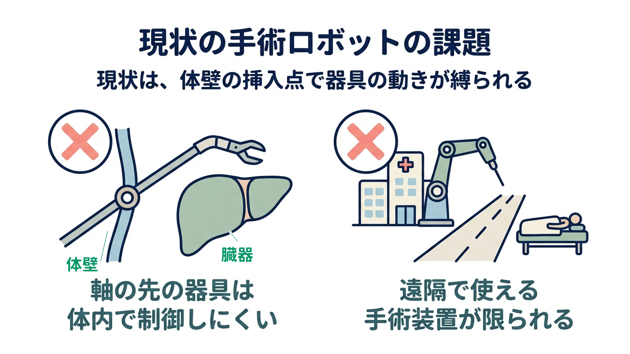 現状の手術ロボットの課題|現状は、体壁の挿入点で器具の動きが縛られる|軸の先の器具は・体内で制御しにくい/遠隔で使える・手術装置が限られる