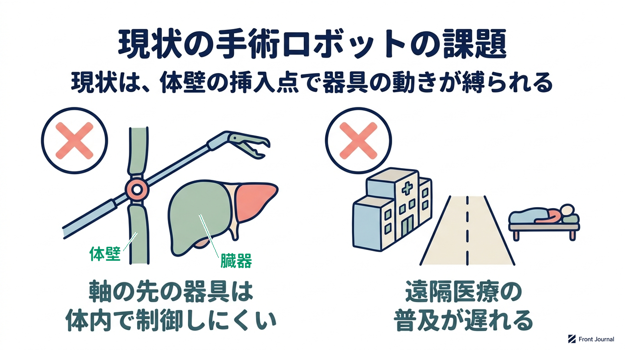 現状の手術ロボットの課題｜現状は、体壁の挿入点で器具の動きが縛られる｜軸の先の器具は・体内で制御しにくい／遠隔医療の・普及が遅れる