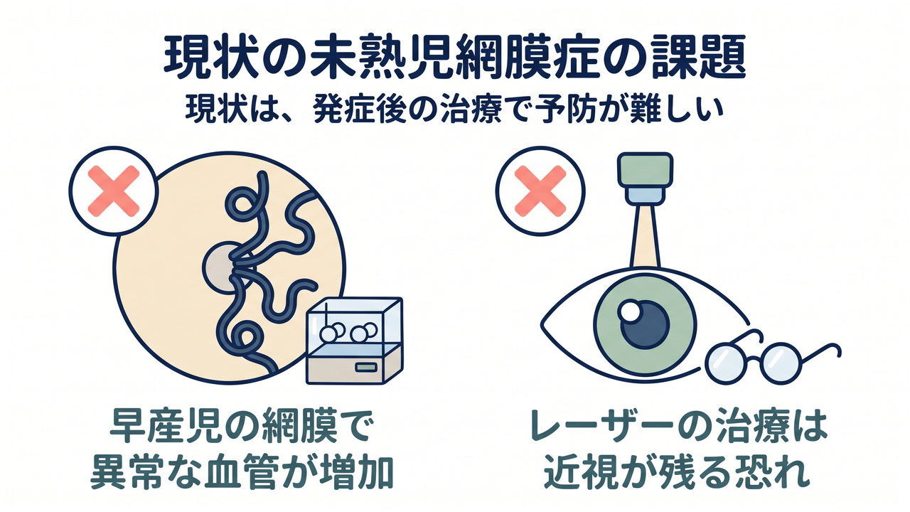 現状の未熟児網膜症の課題|現状は、発症後の治療で予防が難しい/早産児の網膜で、異常な血管が増加/レーザーの治療は、近視が残る恐れ