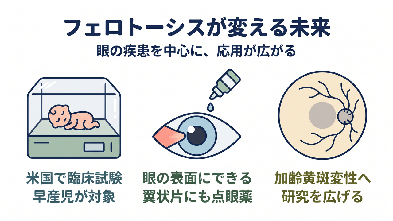 フェロトーシスが変える未来|眼の疾患を中心に、応用が広がる/米国で臨床試験、早産児が対象/眼の表面にできる、翼状片にも点眼薬/加齢黄斑変性へ、研究を広げる