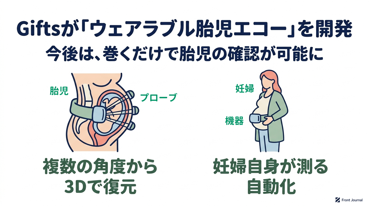 Giftsが「ウェアラブル胎児エコー」を開発