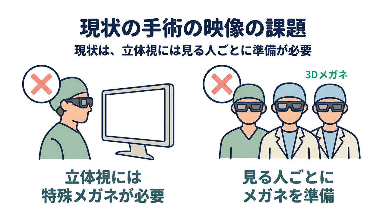 現状の手術の映像の課題｜現状は、立体視には見る人ごとに準備が必要｜立体視には・特殊メガネが必要／見る人ごとに・メガネを準備