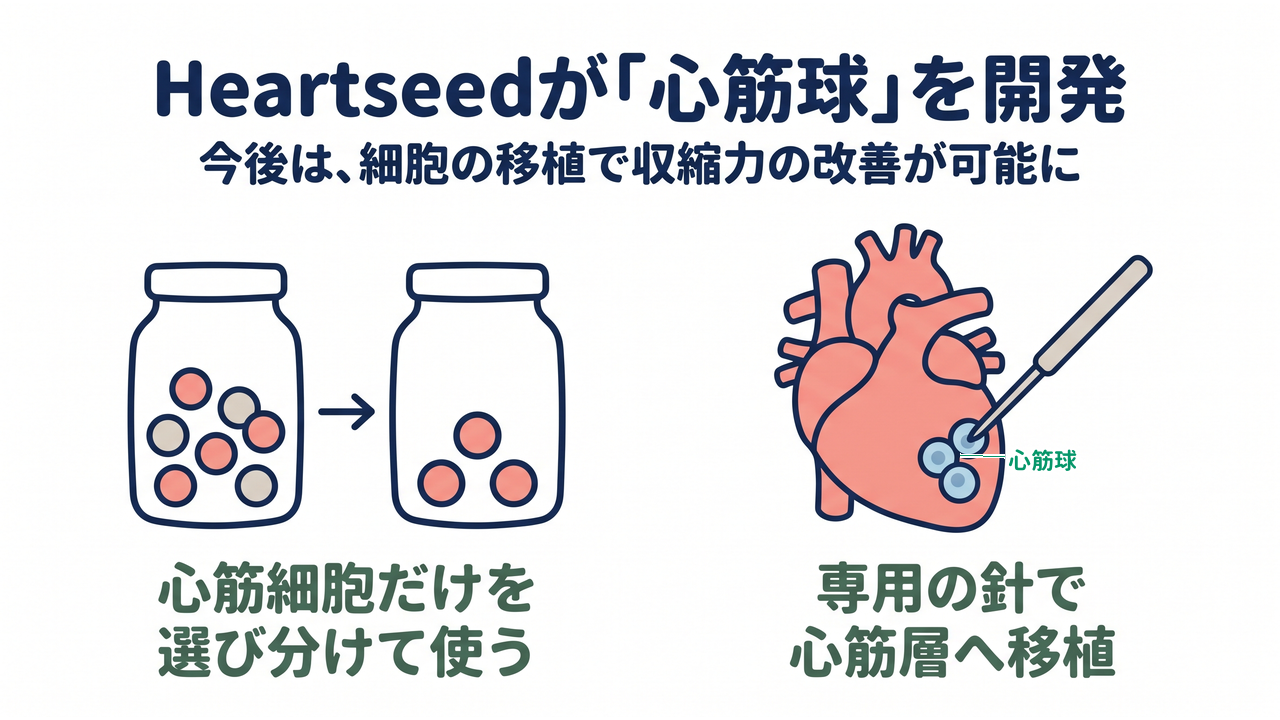 Heartseedが「心筋球」を開発|心筋細胞だけを選び分けて使う/専用の針で心筋層へ移植