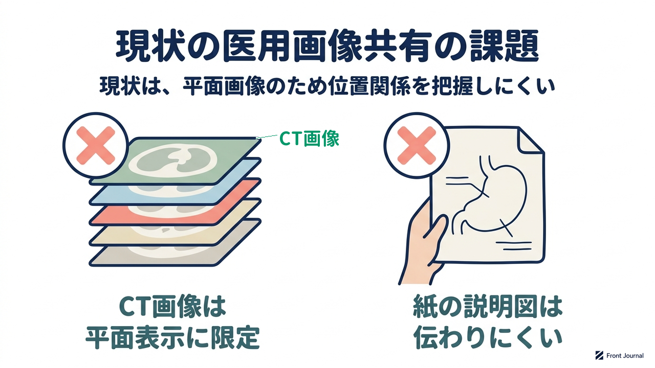 現状の医用画像共有の課題｜現状は、平面画像のため位置関係を把握しにくい／CT画像は平面表示に限られる／紙の説明図は伝わりにくい