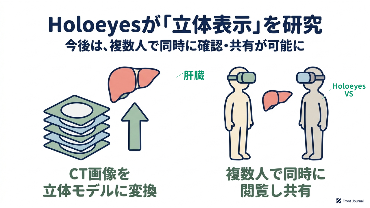 Holoeyesが「立体表示」を研究｜今後は、複数人で同時に確認・共有が可能に／CT画像を立体モデルに変換／複数人で同時に閲覧し共有