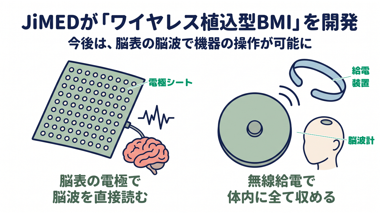 JiMEDが「ワイヤレス植込型BMI」を開発|今後は、脳表の脳波で機器の操作が可能に/脳表の電極で脳波を直接読む/無線給電で体内に全て収める