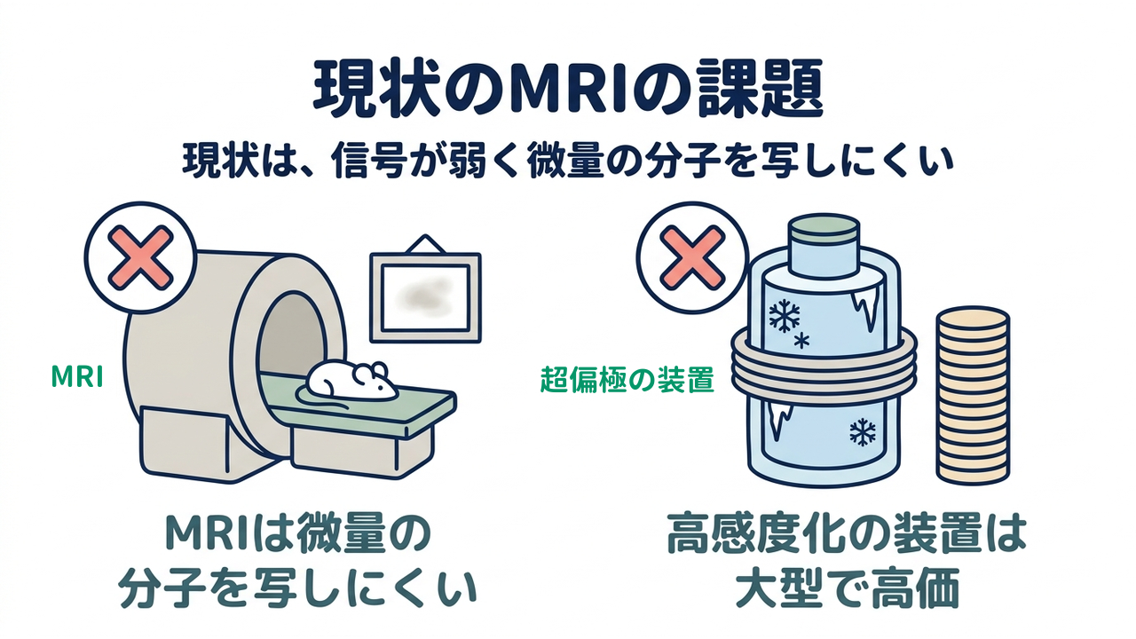 現状のMRIの課題
