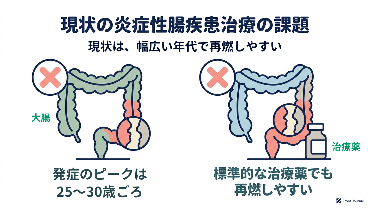 現状の炎症性腸疾患治療の課題