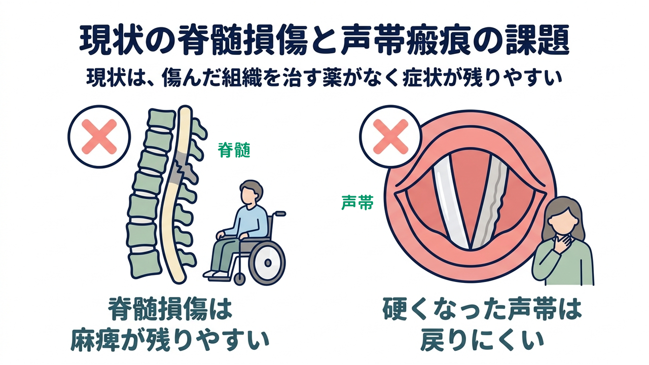 現状の脊髄損傷と声帯瘢痕の課題