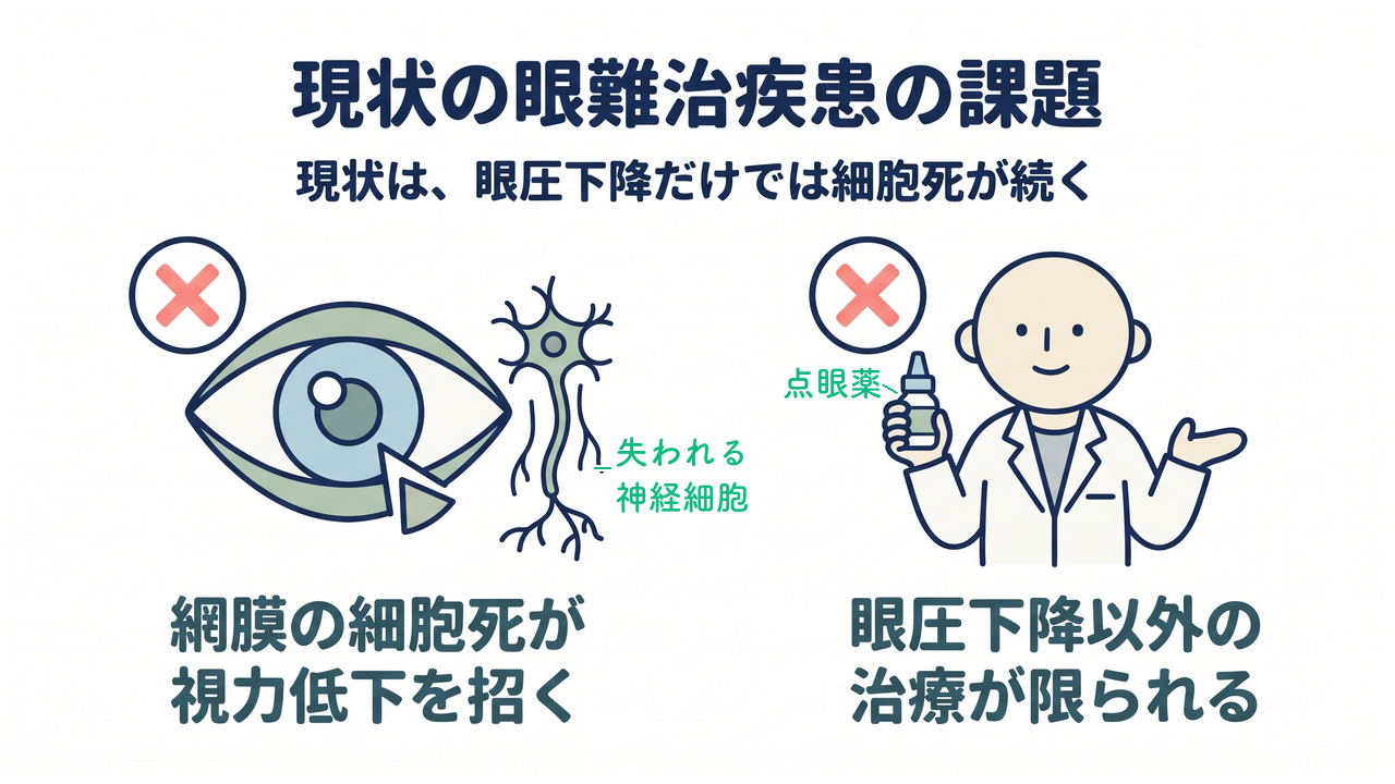 現状の眼難治疾患の課題｜現状は、眼圧下降だけでは細胞死が続く／網膜の細胞死が視力低下を招く／眼圧下降以外の治療が限られる