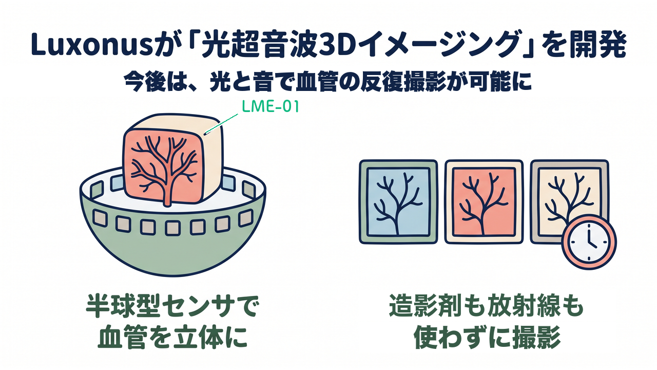Luxonusが「光超音波3Dイメージング」を開発|今後は、光と音で血管の反復撮影が可能に/半球型センサで血管を立体に/造影剤も放射線も使わずに撮影