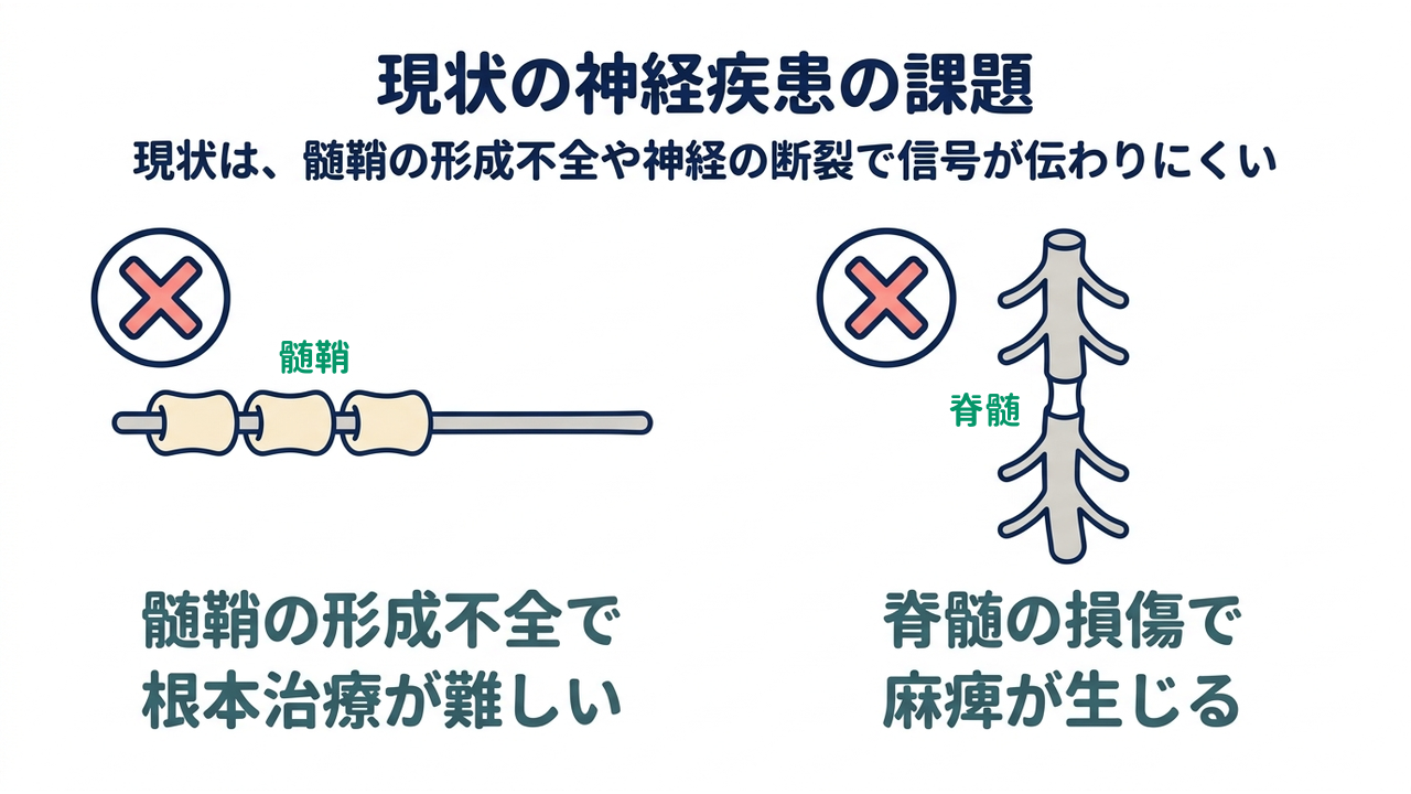 現状の神経疾患の課題｜現状は、髄鞘の形成不全や神経の断裂で信号が伝わりにくい｜髄鞘の形成不全で・根本治療が難しい／脊髄の損傷で・麻痺が生じる