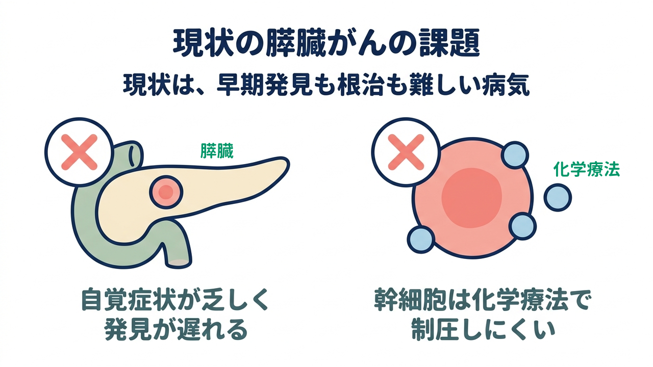 現状の膵臓がんの課題｜現状は、早期発見も根治も難しい病気｜自覚症状が乏しく・発見が遅れる／幹細胞は化学療法で・制圧しにくい