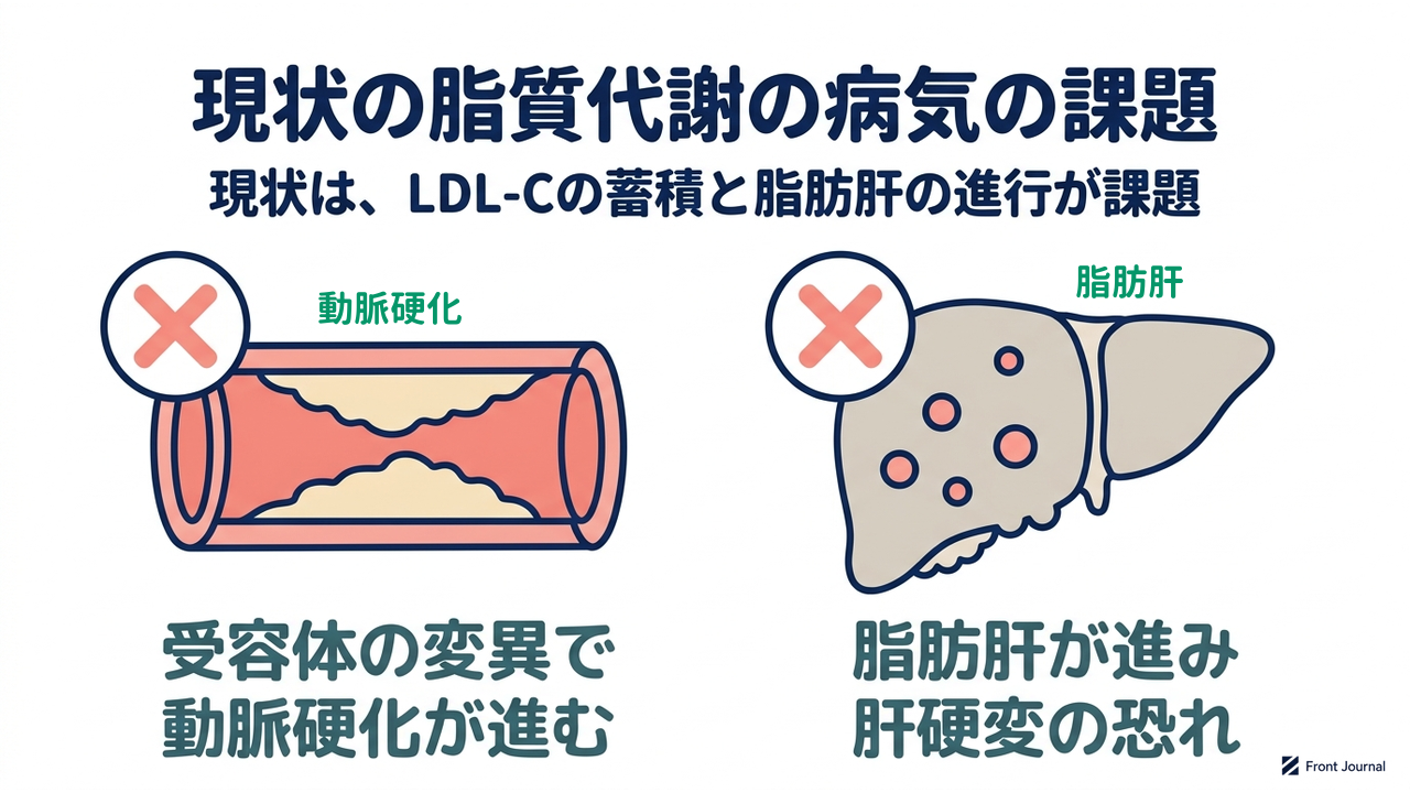 現状の脂質代謝の病気の課題|受容体の変異で動脈硬化が進む/脂肪肝が進み肝硬変の恐れ