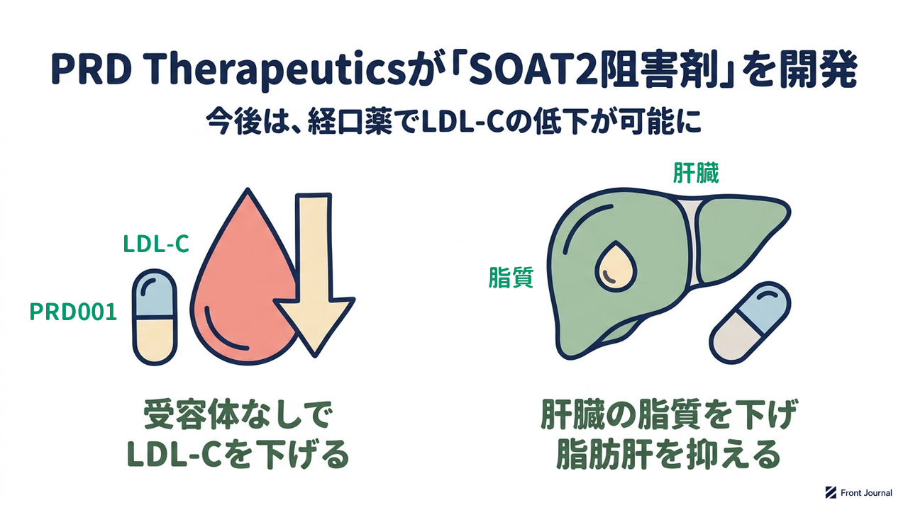 PRD Therapeuticsが「SOAT2阻害剤」を開発|受容体なしでLDL-Cを下げる/肝臓の脂質を下げ脂肪肝を抑える
