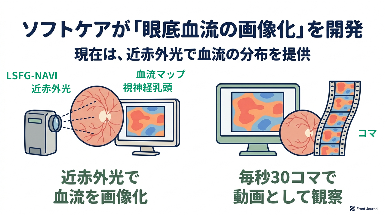 ソフトケアが「眼底血流の画像化」を開発|現在は、近赤外光で血流の分布を提供|近赤外光で・血流を画像化/毎秒30コマで・動画として観察