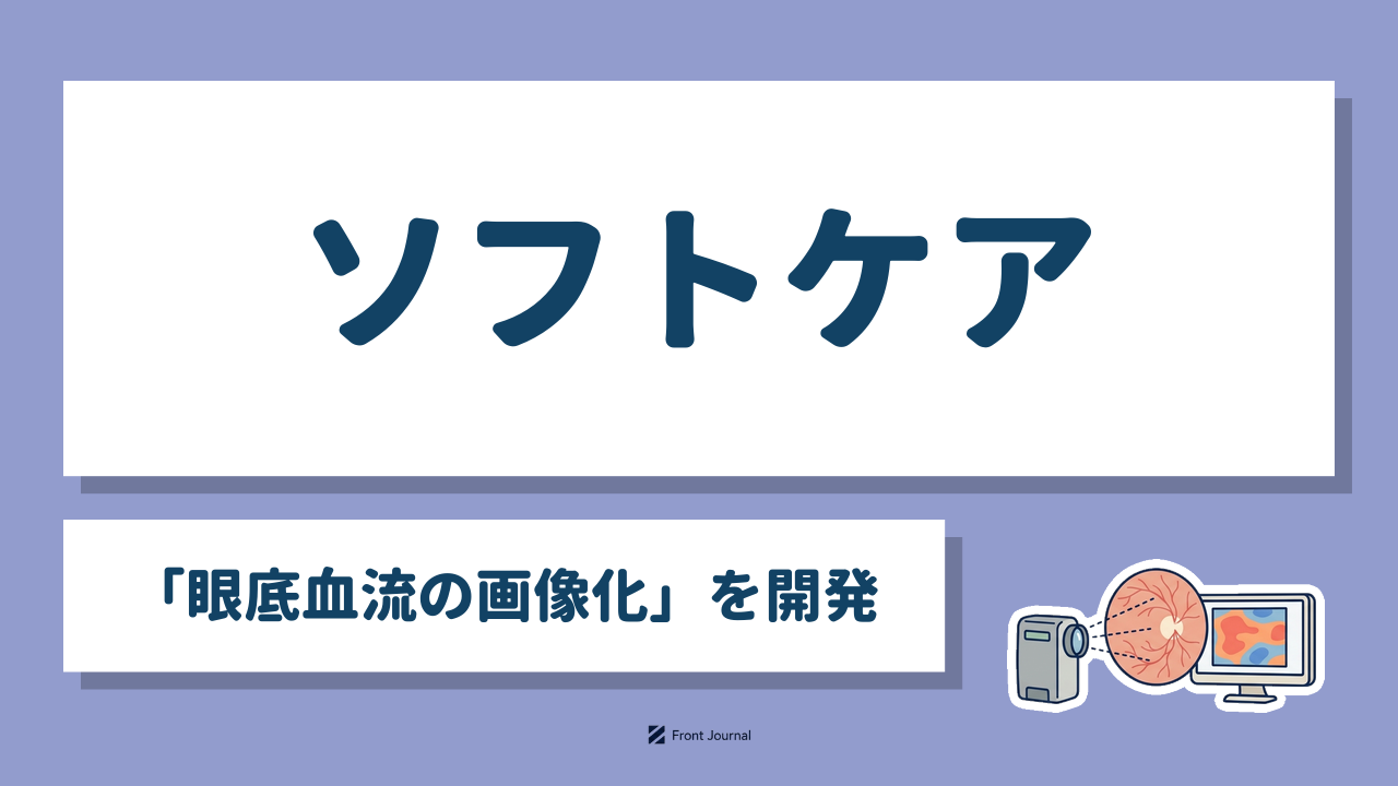 ソフトケア「眼底血流の画像化」を開発