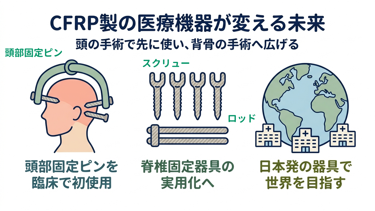 CFRP製の医療機器が変える未来｜頭の手術で先に使い、背骨の手術へ広げる／頭部固定ピンを臨床で初使用／脊椎固定器具の実用化へ／日本発の器具で世界を目指す