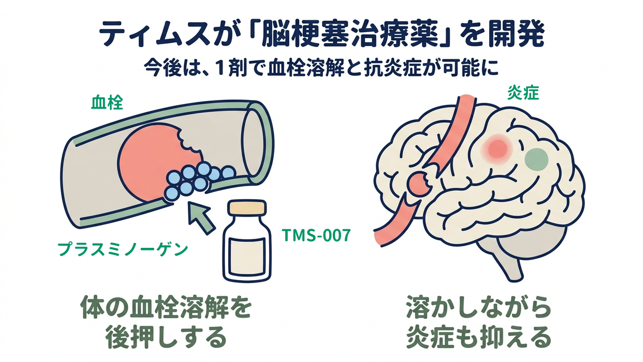ティムスが「脳梗塞治療薬」を開発|今後は、1剤で血栓溶解と抗炎症が可能に/体の血栓溶解を後押しする/溶かしながら炎症も抑える
