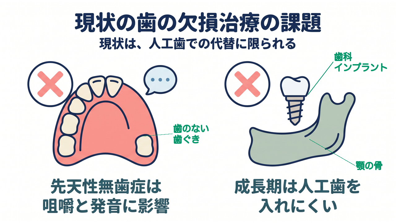 現状の歯の欠損治療の課題｜現状は、人工歯での代替に限られる／先天性無歯症は咀嚼と発音に影響／成長期は人工歯を入れにくい
