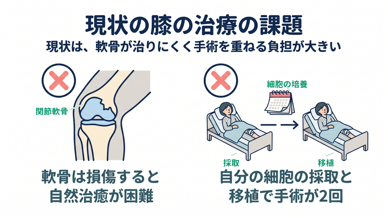 現状の膝の治療の課題｜現状は、軟骨が治りにくく手術を重ねる負担が大きい｜軟骨は損傷すると・自然治癒が困難／自分の細胞の採取と・移植で手術が2回